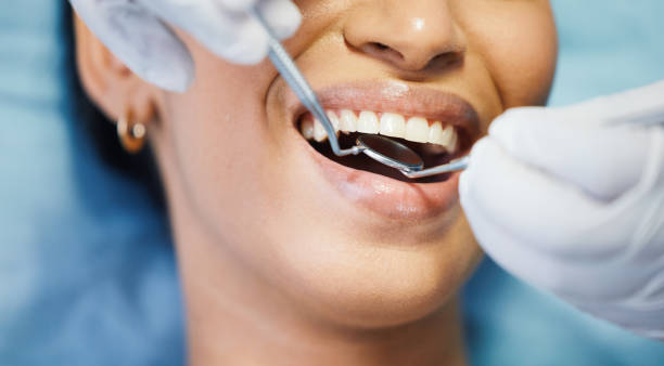 Best Walk-In Emergency Dentist in Universal City, TX